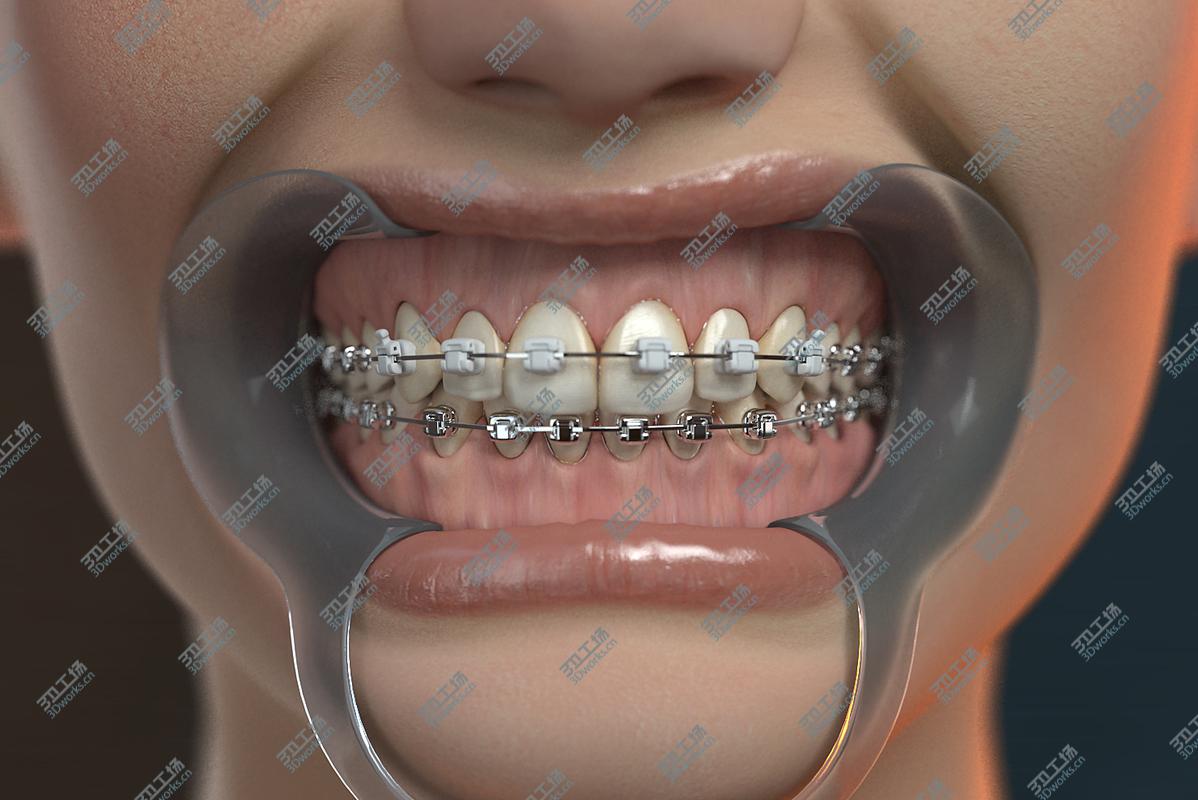 images/goods_img/2021040232/3D model Orthodontic Head (V-Ray)/3.jpg